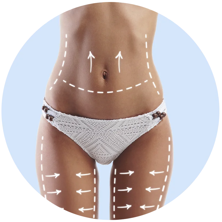 Zona abdominal y muslos con marcas y flechas que indican remodelación corporal mediante tratamientos estéticos no invasivos.