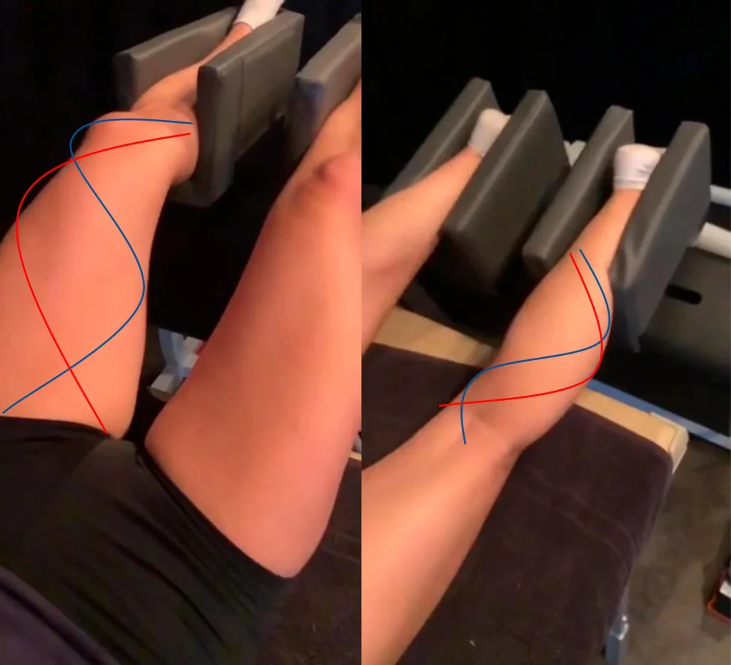 Piernas colocadas en el dispositivo MRM realizando un movimiento ondulatorio de Onda cinética que combina masaje y simulación de esfuerzo físico.